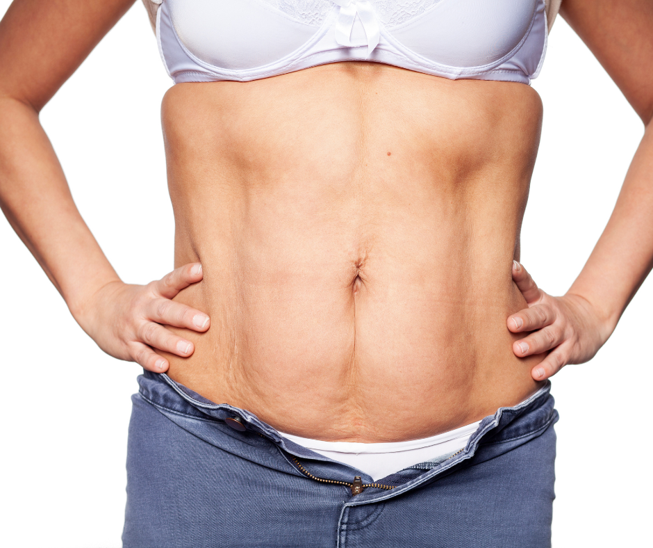 How to Lose Weight and Keep Skin Tight